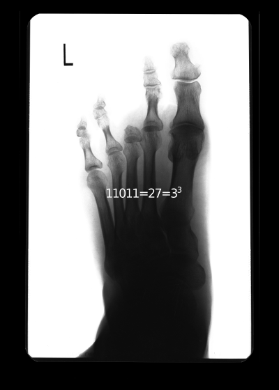 Digiti 27 (Four toes - amputated toe X-ray, 11011=27=3^3)